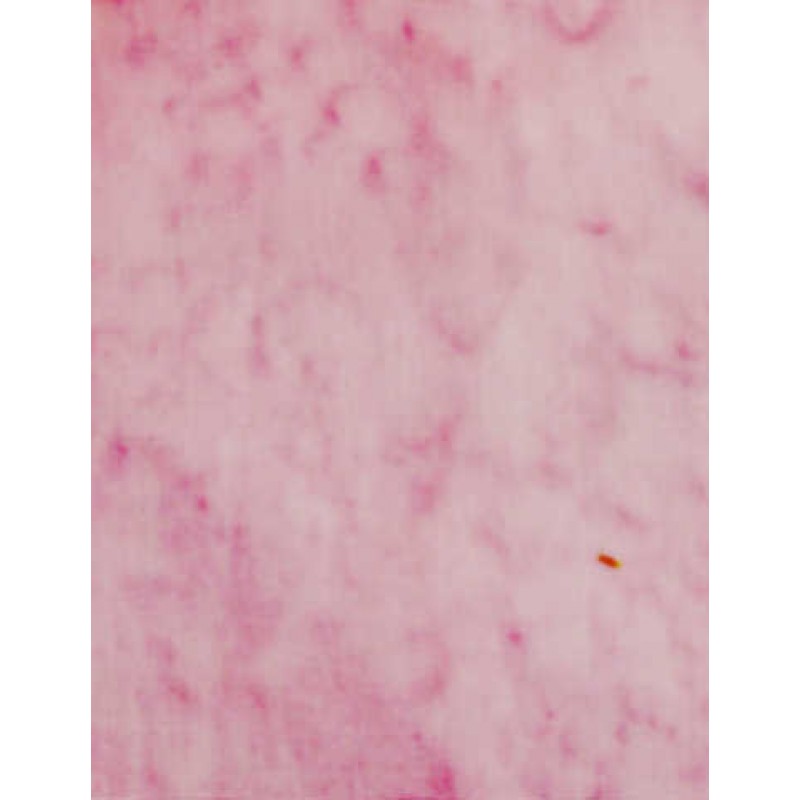 Anthology - 1964 - Lyserød