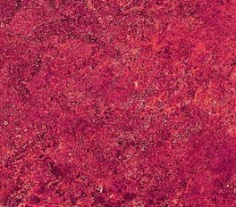 NorthcottGradationMrkPink-20