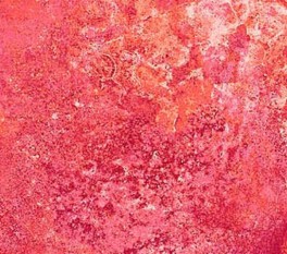 NorthcottGradationMellemPink-20