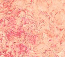 NorthcottGradationLysPink-20