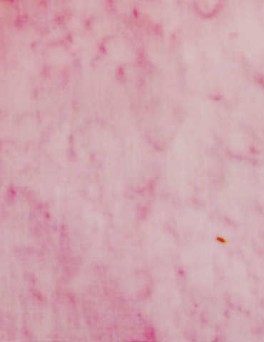 Anthology1964Lyserd-20